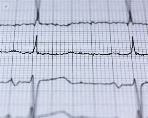 orla palpit|Palpitations: what do they feel like and what are they .